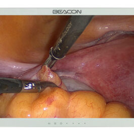Monitor de alta definición para cirugía de 23.6″ S242P