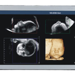 Monitor médico ultrasónico de 19″ U191W